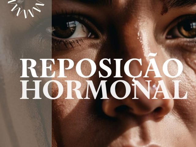 REPOSIÇÃO